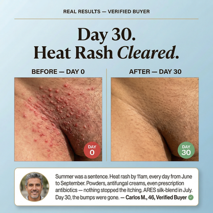 Bóxer de seda premium | Comodidad todo el día